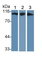 CD166 (ALCAM) Antibody in Western Blot (WB)