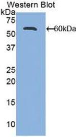 CD166 (ALCAM) Antibody in Western Blot (WB)