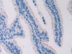 ADCY6 Polyclonal Antibody