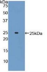 ADCY6 Antibody in Western Blot (WB)