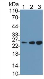 AK3 Polyclonal Antibody