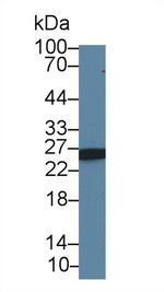 AK3 Antibody in Western Blot (WB)