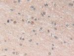 ADRM1 Antibody in Immunohistochemistry (Paraffin) (IHC (P))