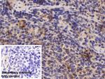 ADRM1 Antibody in Immunohistochemistry (Paraffin) (IHC (P))