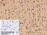ADRM1 Antibody in Immunohistochemistry (Paraffin) (IHC (P))