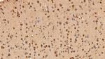 ADRM1 Antibody in Immunohistochemistry (Paraffin) (IHC (P))