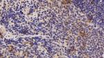 ADRM1 Antibody in Immunohistochemistry (Paraffin) (IHC (P))