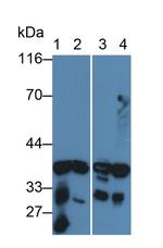 AK1BA Polyclonal Antibody
