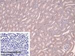 alpha Adducin Polyclonal Antibody