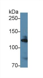 alpha Adducin Antibody in Western Blot (WB)