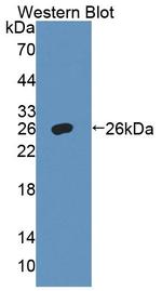 alpha Adducin Antibody in Western Blot (WB)
