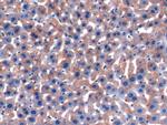 Orm1 Polyclonal Antibody