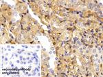 alpha-1 Antitrypsin Antibody in Immunohistochemistry (Paraffin) (IHC (P))