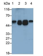 alpha-1 Antitrypsin Antibody in Western Blot (WB)
