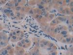 AFP Antibody in Immunohistochemistry (Paraffin) (IHC (P))