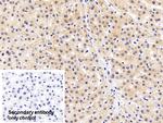 AFP Antibody in Immunohistochemistry (Paraffin) (IHC (P))