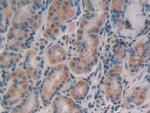 AFP Antibody in Immunohistochemistry (Paraffin) (IHC (P))