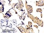 AFP Antibody in Immunohistochemistry (Paraffin) (IHC (P))