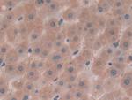 AFP Antibody in Immunohistochemistry (Paraffin) (IHC (P))