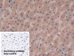 AFP Antibody in Immunohistochemistry (Paraffin) (IHC (P))