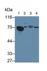 AFP Antibody in Western Blot (WB)