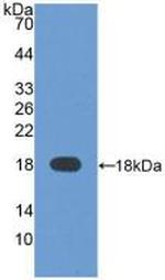 AFP Antibody in Western Blot (WB)