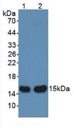 AHSP Antibody in Western Blot (WB)