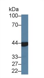 Aminoacylase Antibody in Western Blot (WB)