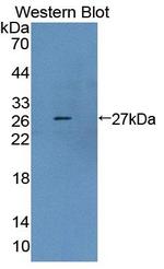 AUP1 Antibody in Western Blot (WB)
