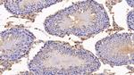 Angiogenin Antibody in Immunohistochemistry (Paraffin) (IHC (P))