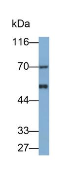 Angiopoietin 2 Antibody in Western Blot (WB)