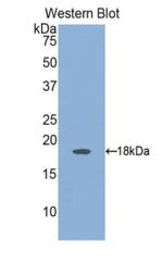 Angiopoietin 2 Antibody in Western Blot (WB)