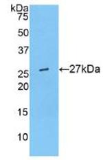 ANGPTL6 Antibody in Western Blot (WB)
