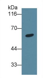 ANGPTL6 Antibody in Western Blot (WB)