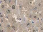 ANTXR2 Antibody in Immunohistochemistry (Paraffin) (IHC (P))