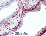 ANTXR2 Antibody in Immunohistochemistry (Paraffin) (IHC (P))