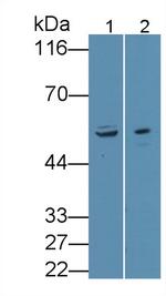 ANTXR2 Antibody in Western Blot (WB)