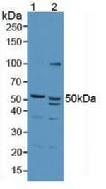 AZIN1 Antibody in Western Blot (WB)