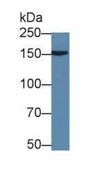 APOB Antibody in Western Blot (WB)