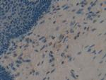 APOF Polyclonal Antibody