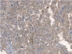 BMAL1 Polyclonal Antibody