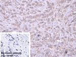 DARS Polyclonal Antibody