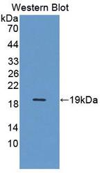 DARS Antibody in Western Blot (WB)