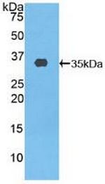 ABCA3 Antibody in Western Blot (WB)