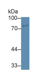 ABCB8 Antibody in Western Blot (WB)