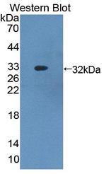 ABCB8 Antibody in Western Blot (WB)