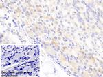 ABCD2 Antibody in Immunohistochemistry (Paraffin) (IHC (P))