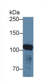 ABCF1 Antibody in Western Blot (WB)