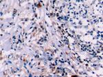 Bcl-2 Antibody in Immunohistochemistry (Paraffin) (IHC (P))