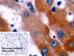 Bcl-2 Antibody in Immunohistochemistry (Paraffin) (IHC (P))